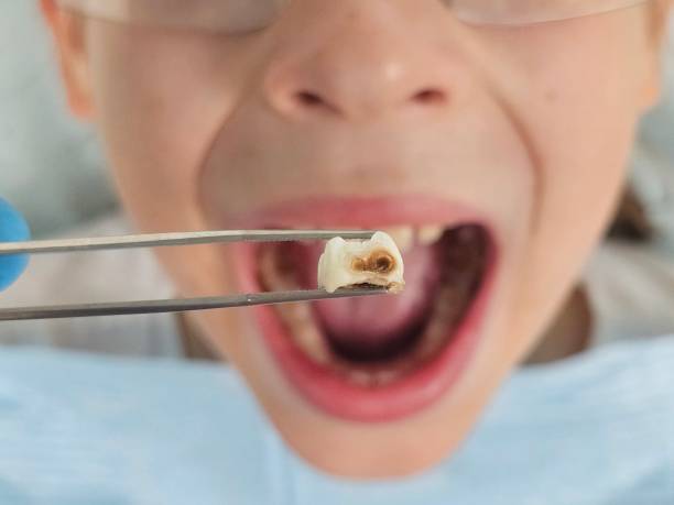 Best Emergency Dental Surgery in Hellertown, PA